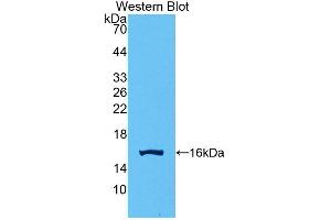 Detection of Recombinant GDF15, Human using Polyclonal Antibody to Growth Differentiation Factor 15 (GDF15) (GDF15 antibody  (AA 195-308))