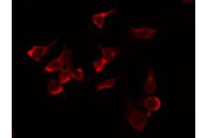 ABIN6266843 staining HuvEc by IF/ICC. (NAA15 antibody  (Internal Region))