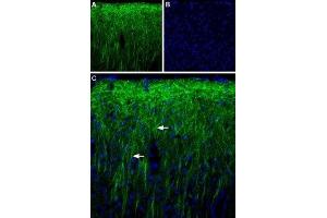 Expression of PEX5-related protein in rat brain - Immunohistochemical staining of rat parietal cortex using Anti-PEX5L (TRIP8b) Antibody (ABIN7043433, ABIN7045126 and ABIN7045127), (1:300). (Peroxisomal Biogenesis Factor 5-Like (PEX5L) (AA 151-165), (Intracellular) antibody)