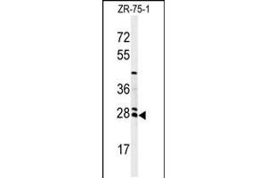 Western blot analysis of NAT8 Antibody in ZR-75-1 cell line lysates (35ug/lane)