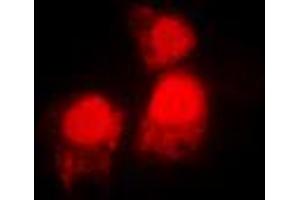 Immunofluorescent analysis of SIAH2 staining in MCF7 cells. (SIAH2 antibody  (C-Term))