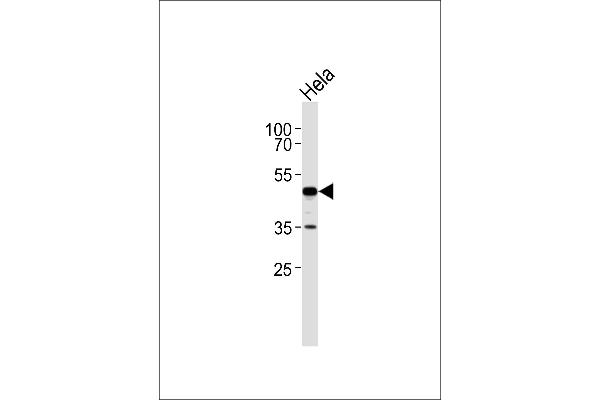 ERI1 antibody