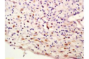 Formalin-fixed and paraffin embedded human placenta labeled with Anti-lamin A/C Polyclonal Antibody, Unconjugated (ABIN735188) at 1:200 followed by conjugation to the secondary antibody and DAB staining (Lamin A/C antibody  (AA 1-100))