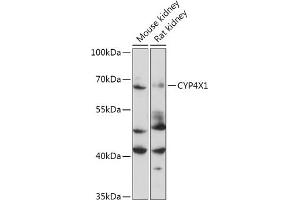 Western blot analysis of extracts of Mouse kidney, using CYP4X1 antibody (ABIN7266659) at 1:1000 dilution. (CYP4X1 antibody  (AA 190-290))