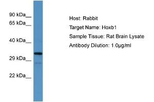 Host:  Rabbit  Target Name:  Hoxb1  Sample Type:  Rat Brain lysates  Antibody Dilution:  1. (HOXB1 antibody  (N-Term))