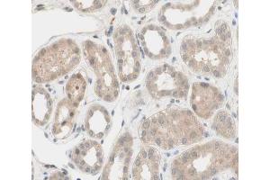 ABIN6266539 at 1/100 staining human kidney tissue sections by IHC-P. (FGFR2 antibody  (C-Term))