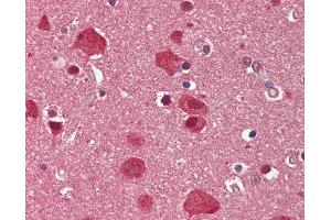 Immunohistochemistry (IHC) image for anti-SWI/SNF Related, Matrix Associated, Actin Dependent Regulator of Chromatin, Subfamily D, Member 3 (SMARCD3) (AA 265-314) antibody (ABIN6755396)