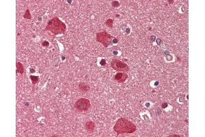 Human Brain, Cortex: Formalin-Fixed, Paraffin-Embedded (FFPE). (SMARCD3 antibody  (AA 265-314))