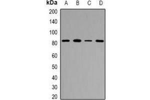 Western blot analysis of ZP2 expression in MCF7 (A), HeLa (B), RAW264. (ZP2 antibody)