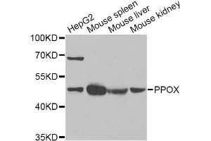 Western blot analysis of extracts of various cell lines, using PPOX Antibody (ABIN2564653) at 1:1000 dilution.