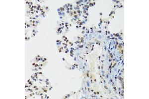 Immunohistochemistry of paraffin-embedded mouse lung using BAZ1B antibody (ABIN6003583) at dilution of 1/100 (40x lens).
