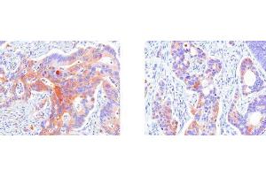 Immunohistochemistry (IHC) image for anti-Heat Shock 27kDa Protein 1 (HSPB1) (AA 1-205), (N-Term) antibody (ABIN317528)