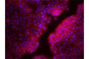 Immunofluorescence (IF) image for anti-Chemokine (C-X-C Motif) Receptor 4 (CXCR4) antibody (ABIN2664314) (CXCR4 antibody)