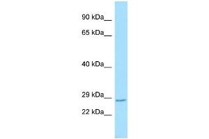 Host: Rabbit Target Name: Rnf13 Sample Type: Mouse Lung lysates Antibody Dilution: 1. (RNF13 antibody  (C-Term))