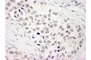 anti-Nuclear Receptor Coactivator 5 (NCOA5) (C-Term) antibody