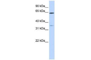 TRIM45 antibody used at 1 ug/ml to detect target protein. (TRIM45 antibody  (Middle Region))