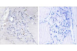 Peptide - +Immunohistochemistry analysis of paraffin-embedded human thyroid gland tissue using C9orf89 antibody. (C9orf89 antibody)