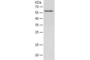 Western Blotting (WB) image for Annexin A1 (ANXA1) (AA 24-346) protein (His-IF2DI Tag) (ABIN7285238) (Annexin a1 Protein (AA 24-346) (His-IF2DI Tag))