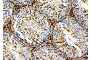 ABIN6254898 and ABIN6279150 at 1/100 staining Mouse testis tissue by IHC-P. (ATXN7L1 antibody  (N-Term))