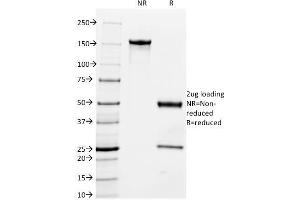 SDS-PAGE Analysis Purified Milk Fat Globule Monoclonal Antibody (MFG-06). (MFGE8 antibody)