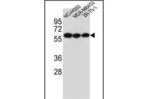 CHRNA10 Antibody (Center) (ABIN656120 and ABIN2845459) western blot analysis in NCI-,MDA-M,ZR-75-1 cell line lysates (35 μg/lane).