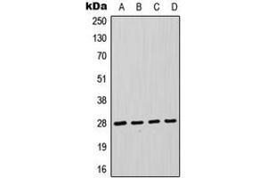 Western blot analysis of FADD expression in HeLa (A), Jurkat (B), THP1 (C), A431 (D) whole cell lysates.