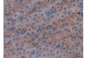 Detection of LAMA1 in Rat Stomach Tissue using Polyclonal Antibody to Laminin Alpha 1 (LAMA1) (Laminin alpha 1 antibody  (AA 1156-1276))