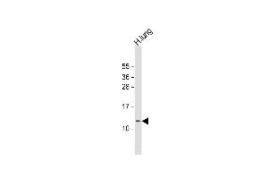 Anti-RIG Antibody (C-Term) at 1:1000 dilution + human lung lysate Lysates/proteins at 20 μg per lane. (DIRAS1 antibody  (AA 58-87))