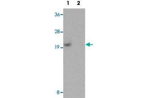 Western blot analysis of human kidney tissue with PIAS1 polyclonal antibody  at 1 ug/mL in (Lane 1) the absence and (Lane 2) the presence of blocking peptide.