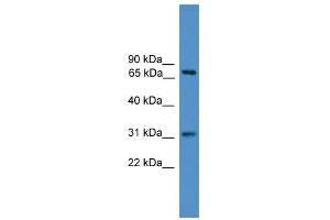 WB Suggested Anti-ZNF471 Antibody Titration:  0. (ZNF471 antibody  (N-Term))