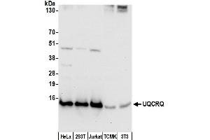 anti-Ubiquinol-Cytochrome C Reductase, Complex III Subunit VII, 9.5kDa (UQCRQ) (AA 32-82) antibody