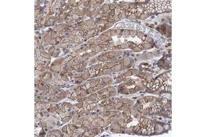 Immunohistochemical staining of human stomach with LRCH4 polyclonal antibody  shows moderate cytoplasmic and membranous positivity in glandular cells.