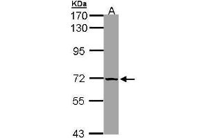 WB Image Sample (30 ug of whole cell lysate) A: 293T 7. (slc25a13 antibody)
