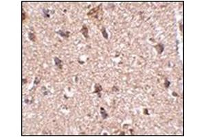 Immunohistochemistry of JPH3 in human brain tissue with this product at 2. (Junctophilin 3 antibody  (Center))