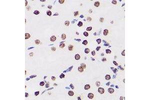 Immunohistochemical analysis of WDR5 staining in human kidney formalin fixed paraffin embedded tissue section. (WDR5 antibody)