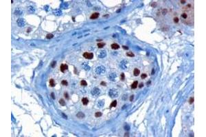 ABIN185160 (3µg/ml) staining of paraffin embedded Human Testis. (KPNA4 antibody  (C-Term))