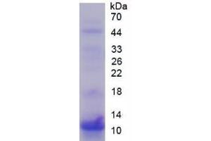 SDS-PAGE of Protein Standard from the Kit (Highly purified E. (S100P ELISA Kit)
