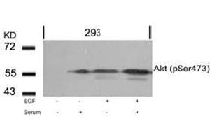 Image no. 2 for anti-V-Akt Murine Thymoma Viral Oncogene Homolog 1 (AKT1) (pSer473) antibody (ABIN196709) (AKT1 antibody  (pSer473))