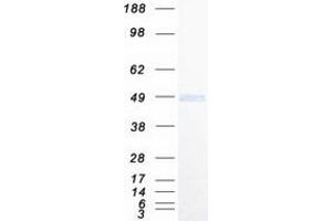 Validation with Western Blot