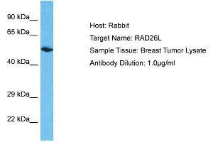 Host: Rabbit Target Name: RAD26L Sample Type: Breast Tumor lysates Antibody Dilution: 1. (ERCC6L2 antibody  (N-Term))