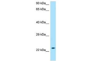 WB Suggested Anti-SLC50A1 AntibodyTitration: 1. (SLC50A1 antibody  (C-Term))