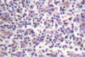 Image no. 1 for anti-B-Raf proto-oncogene, serine/threonine kinase (BRAF) antibody (ABIN271999) (BRAF antibody)