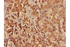 Immunohistochemistry of paraffin-embedded human liver tissue using ABIN7158499 at dilution of 1:100 (ACADL antibody  (AA 30-260))