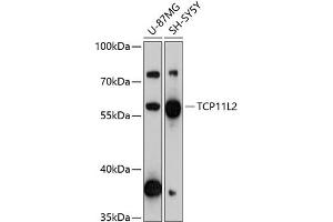 Western blot analysis of extracts of various cell lines, using TCP11L2 antibody (ABIN6133204, ABIN6148958, ABIN6148959 and ABIN6217166) at 1:3000 dilution. (TCP11L2 antibody  (AA 1-340))