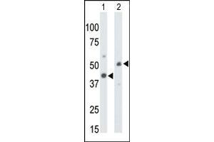 Western blot analysis using AP13637PU-N CKMT1 antibody to detect CKMT1 in Mouse colon tissue lysate (Lane 1) and ZR-75-1 cell lysate (Lane 2). (CKMT1B antibody  (N-Term))