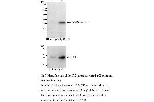 Western Blotting (WB) image for anti-Tumor Protein P53 (TP53) (pSer315) antibody (ABIN3201006) (p53 antibody  (pSer315))