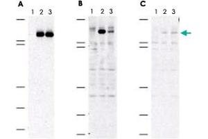 Immunoblot of MAP3K5 (phospho S83) polyclonal antibody  shows specificity for phosphorylated human MAP3K5. (ASK1 antibody  (pSer83))