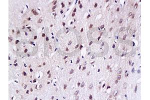 Formalin-fixed and paraffin embedded rat brain tissue labled with Anti-LAMR1 Polyclonal Antibody, unconjugated (ABIN729583)  at 1: 200, followed by incubation with conjugated secondary antibody and DAB staining (RPSA/Laminin Receptor antibody  (AA 101-200))