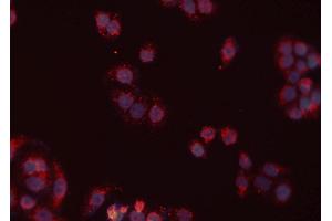 ABIN6277430 staining Hela cells by IF/ICC. (RAD52 antibody  (Internal Region))