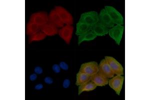 ABIN6257699 and ABIN6274595 staining Hela cells(30 min of UV treatment) by IF/ICC. (OB Cadherin antibody  (Internal Region))